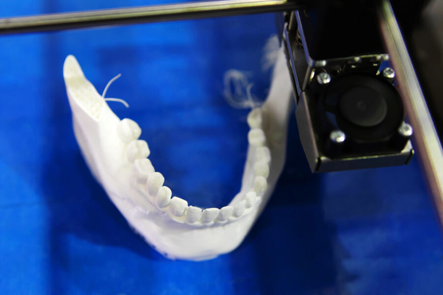 Zukunft des Zahnersatzes: Digitale Verfahren, 3D-Druck und die Grenzen personalisierter Versorgung